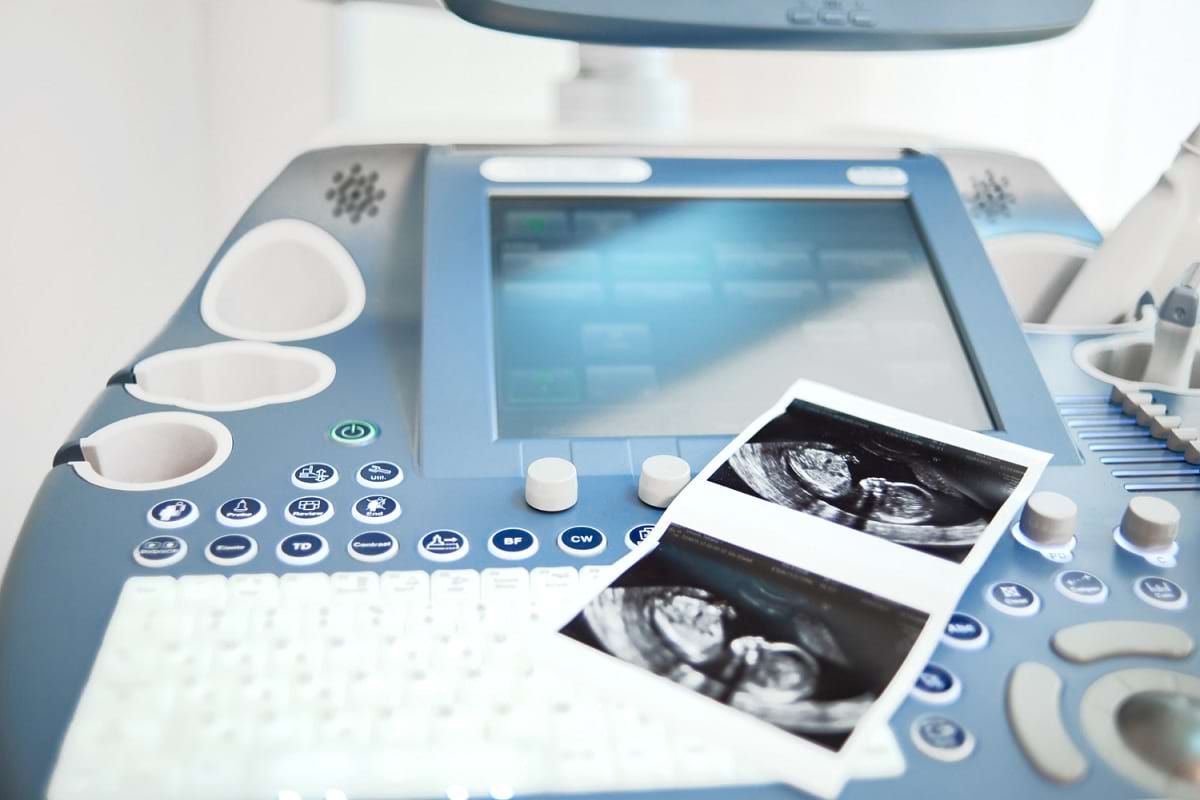 ultrasonografy przenośne